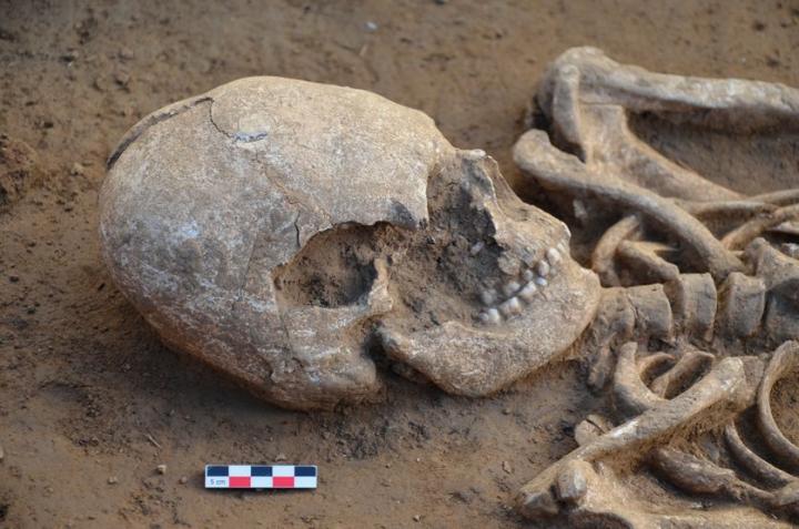 Crâne déformé d’un individu découvert dans une tombe du site de Seysses (sépulture 1046)