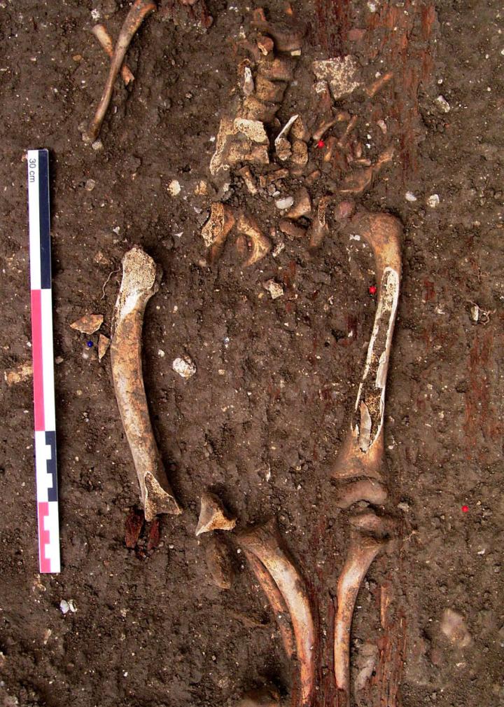 Détail des membres inférieurs d’un squelette d’enfant atteint de rachitisme mis au jour à Charenton (Val-de- Marne), dans un ancien cimetière protestant. Détail des membres inférieurs d’un squelette d’enfant atteint de rachitisme mis au jour à Charenton (Val-de- Marne), dans un ancien cimetière protestant.