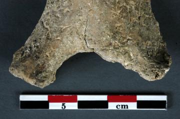 Une opération chirurgicale il y a 7000 ans : la plus ancienne amputation découverte en France