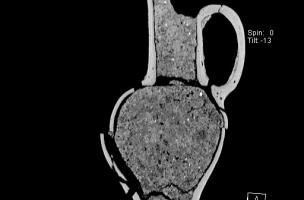 Aleria études 11
