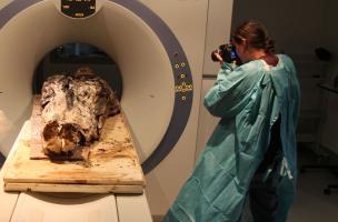Scanner d'un corps exceptionnellement bien conservé découvert dans un cercueil de plomb mis au jour au couvent des Jacobins, à Rennes (Ille-et-Vilaine), 2015.  Un premier scanner du corps entier habillé est réalisé (ImagET, Mordelles, 35) pour évaluer le 