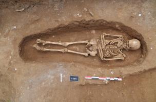Dans cette sépulture carolingienne, un linceul enveloppant a été associé à la présence d’une pierre placée sous le menton Dans cette sépulture carolingienne, un linceul enveloppant a été associé à la présence d’une pierre placée sous le menton
