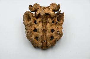 Le sacrum du sujet de la sépulture 997 montre une spina bifida occulta Le sacrum du sujet de la sépulture 997 montre une spina bifida occulta