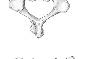 Adaïma ; stigmates d'égorgement et de tentative de décollation sur une vertèbre cervicale.