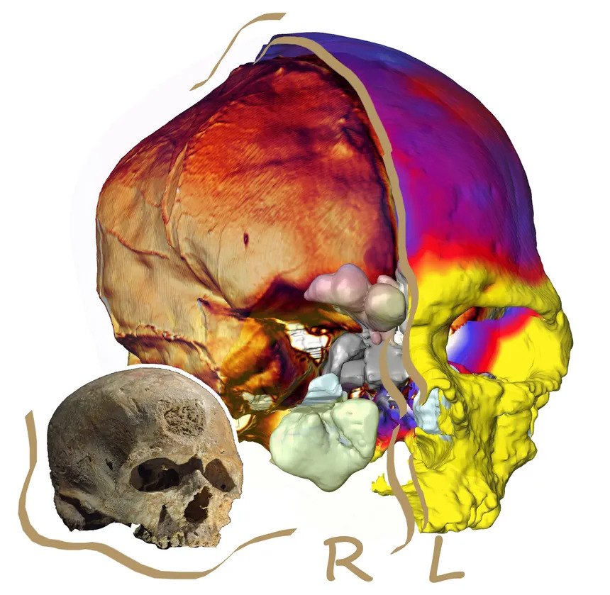 Illustration des caractéristiques du crane et du cerveau de l'Homme de Cro-Magnon (technique du paleobrain) 860_cmasymmetry.jpeg